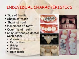INDIVIDUAL CHARACTERISTICS
 Size of tooth
 Shape of tooth
 Shape of root
 Placement of tooth
 Quantity of teeth
 Combinations of dental
work done:
 Crowns
 Extractions
 Bridge
 Fillings
 Root canals
 