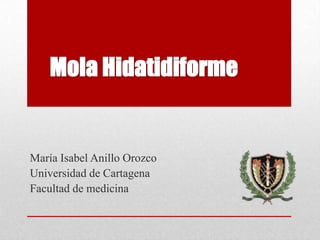 María Isabel Anillo Orozco
Universidad de Cartagena
Facultad de medicina
 