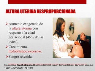 ALTURA UTERINA DESPROPORCIONADA

 Aumento exagerado de
  la altura uterina con
  respecto a la edad
  gestacional (45% de las
  pctes).
 Crecimiento
  trofoblástico excesivo.
 Sangre retenida

Gestational Trophoblastic Disease (Clinical Expert Series).Obstet Gynecol, Volume
108(1). July 2006(176-187)
 