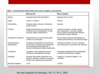 MOLA COMPLETA Y PARCIAL

   Revista Española de Patología. Vol. 35, No 2; 2003
 