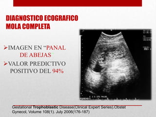 DIAGNOSTICO ECOGRAFICO
MOLA COMPLETA

IMAGEN EN “PANAL
     DE ABEJAS”
VALOR PREDICTIVO
  POSITIVO DEL 94%




  Gestational Trophoblastic Disease(Clinical Expert Series).Obstet
  Gynecol, Volume 108(1). July 2006(176-187)
 
