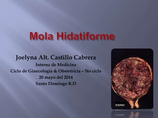 Joelyna Alt. Castillo Cabrera
Interna de Medicina
Ciclo de Ginecología & Obstetricia – 5to ciclo
20 mayo del 2014
Santo Domingo R.D
 