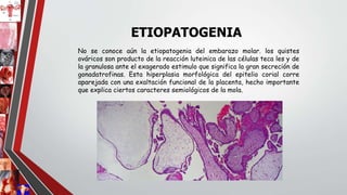 No se conoce aún la etiopatogenia del embarazo molar. los quistes
ováricos son producto de la reacción luteinica de las células teca les y de
la granulosa ante el exagerado estimulo que significa la gran secreción de
gonadatrofinas. Esta hiperplasia morfológica del epitelio corial corre
aparejada con una exaltación funcional de la placenta, hecho importante
que explica ciertos caracteres semiológicos de la mola.
ETIOPATOGENIA
 