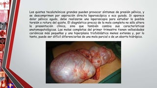 Los quistes tecaluteínicos grandes pueden provocar síntomas de presión pélvica, y
se descomprimen por aspiración directa laparoscópica o eco guiada. Si aparece
dolor pélvico agudo, debe realizarse una laparoscopia para estudiar la posible
torsión o rotura del quiste. El diagnóstico precoz de la mola completa no sólo altera
la presentación clínica, sino que también cambia sus características
anatomopatológicas. Las molas completas del primer trimestre tienen vellosidades
coriónicas más pequeñas y una hiperplasia trofoblástica menos extensa y, por lo
tanto, puede ser difícil diferenciarlas de una mola parcial o de un aborto hidrópico.
 