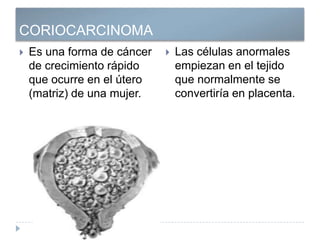 CORIOCARCINOMA
 Es una forma de cáncer
de crecimiento rápido
que ocurre en el útero
(matriz) de una mujer.
 Las células anormales
empiezan en el tejido
que normalmente se
convertiría en placenta.
 