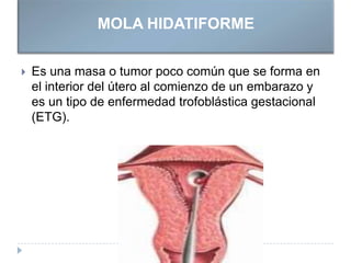 MOLA HIDATIFORME
 Es una masa o tumor poco común que se forma en
el interior del útero al comienzo de un embarazo y
es un tipo de enfermedad trofoblástica gestacional
(ETG).
 