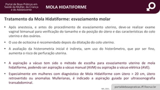 portaldeboaspraticas.iff.fiocruz.br
MOLA HIDATIFORME
Tratamento da Mola Hidatiforme: esvaziamento molar
MS, 2021.
• Após anestesia, e antes do procedimento de esvaziamento uterino, deve-se realizar exame
vaginal bimanual para verificação do tamanho e da posição do útero e das características do colo
uterino e dos ovários.
• O uso de ocitocina é recomendado depois da dilatação do colo uterino.
• A avaliação da histerometria inicial é indireta, sem uso do histerômetro, que por ser fino,
aumenta o risco de perfuração uterina.
• A aspiração a vácuo tem sido o método de escolha para esvaziamento uterino de mola
hidatiforme, podendo ser aspiração a vácuo manual (AVM) ou aspiração a vácuo elétrica (AVE).
• Especialmente em mulheres com diagnóstico de Mola Hidatiforme com útero > 20 cm, útero
retrovertido ou anomalias Mullerianas, é indicado a aspiração guiada por ultrassonografia
transabdominal.
 
