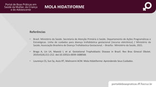 portaldeboaspraticas.iff.fiocruz.br
MOLA HIDATIFORME
• Brasil. Ministério da Saúde. Secretaria de Atenção Primária à Saúde. Departamento de Ações Programáticas e
Estratégicas. Linha de cuidados para doença trofoblástica gestacional [recurso eletrônico] / Ministério da
Saúde; Associação Brasileira de Doença Trofoblastica Gestacional. – Brasília : Ministério da Saúde, 2021.
• Braga A, Lin LH, Maestá I, et al. Gestational Trophoblastic Disease in Brazil. Rev Bras Ginecol Obstet.
2019;41(4):211-212. doi:10.1055/s-0039-1688566
• Lourenço CS, Sun Sy, Assis RT, Malinverni ACM. Mola Hidatiforme: Aprendendo Seus Cuidados.
Referências
 