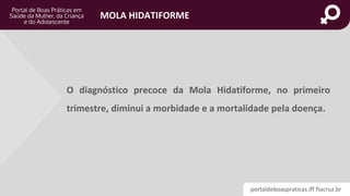 portaldeboaspraticas.iff.fiocruz.br
MOLA HIDATIFORME
O diagnóstico precoce da Mola Hidatiforme, no primeiro
trimestre, diminui a morbidade e a mortalidade pela doença.
 