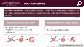 portaldeboaspraticas.iff.fiocruz.br
MOLA HIDATIFORME
Fonte: Lourenço e Sun
A mola hidatiforme é uma gravidez anormal com proliferação exagerada da placenta,
havendo no geral, atraso menstrual e exacerbação de todas as manifestações comuns à
gestação.
Mola Hidatiforme Parcial (MHP)
• Há geração do bebê com
malformação, sem chances de
sobreviver
Mola Hidatiforme Completa (MHC)
• Não há a geração do bebê
MS, 2021.
 