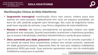 portaldeboaspraticas.iff.fiocruz.br
MOLA HIDATIFORME
Manifestações Clínicas da Mola Hidatiforme
MS, 2021.
• Sangramento transvaginal: manifestação clínica mais comum, embora possa estar
ausente em casos precoces. Habitualmente tem início em pequena quantidade, em
borra de café, podendo progredir para hemorragia. Nos casos de diagnóstico tardio,
pode haver expulsão de vesículas, o que firma o diagnóstico de mola hidatiforme.
• Náuseas e vômitos: são comuns, principalmente em gestações molares com idade
gestacional mais avançada. Quando exacerbados caracterizam a hiperêmese gravídica,
que se associa à desidratação, distúrbios hidroeletrolíticos e perda de peso corporal.
• Útero aumentado para idade gestacional (maior que 4 cm do tamanho esperado): é
um achado de exame físico característico, embora nem sempre presente, sobretudo
em idade gestacional precoce. Representa fator de risco para neoplasia trofoblástica
gestacional (NTG) pós-molar. Essas pacientes apresentam maior risco de embolização
trofoblástica maciça para os pulmões.
 