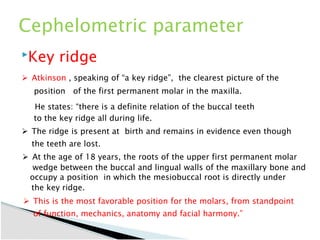 molar-distalization in orthodontics-seminar.pptx