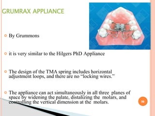 molar-distalization in orthodontics-seminar.pptx