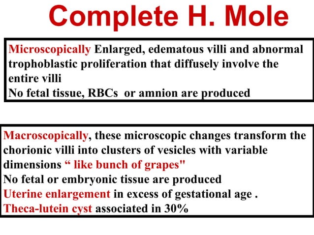 Molar pregnancy | PPT
