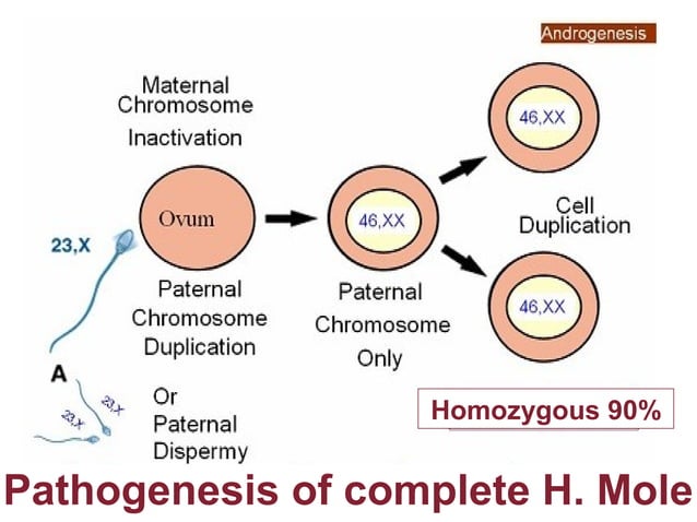 Molar pregnancy
