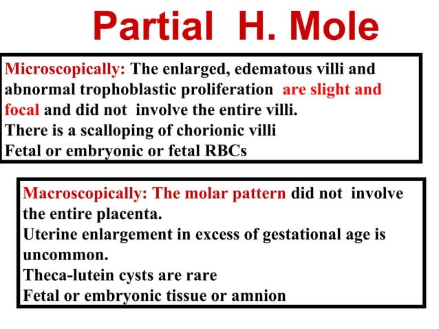 Molar pregnancy