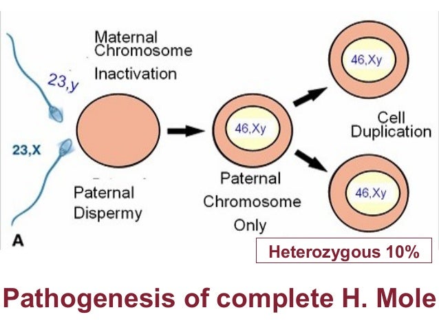 Molar pregnancy