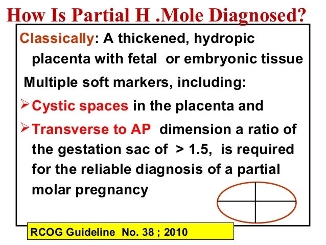Image result for management of molar pregnancy rcog