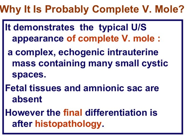 What Is The Evidence ?The Management Of  Gestational Trophoblastic  DiseaseRCOG Guideline  No. 38 ;  2010 