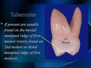 Tooth Marginal Ridge Gum Permanent teeth molars of the human teeth | PPTX
