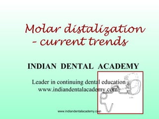 Molar distalization
– current trends
INDIAN DENTAL ACADEMY
Leader in continuing dental education
www.indiandentalacademy.com

www.indiandentalacademy.com

 
