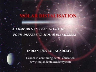 MOLAR DISTALISATION
A COMPARITIVE CASE STUDY OF
FOUR DIFFERENT MOLAR DIATALISERS
www.indiandentalacademy.com
INDIAN DENTAL ACADEMY
Leader in continuing dental education
www.indiandentalacademy.com
 