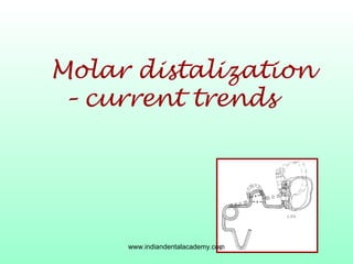 Molar distalization
– current trends
www.indiandentalacademy.com
 