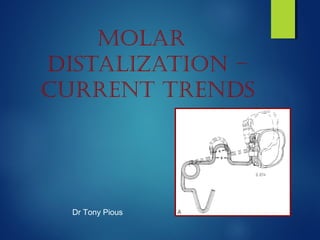 Molar
distalization –
current trends
Dr Tony Pious
 