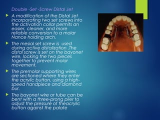 Distalisation Jet Molar distalisation | PPT