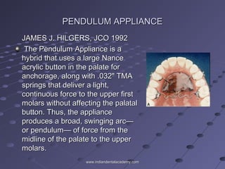 PENDULUM APPLIANCEPENDULUM APPLIANCE
JAMES J. HILGERS, JCO 1992JAMES J. HILGERS, JCO 1992
The Pendulum Appliance is aThe Pendulum Appliance is a
hybrid that uses a large Nancehybrid that uses a large Nance
acrylic button in the palate foracrylic button in the palate for
anchorage, along with .032" TMAanchorage, along with .032" TMA
springs that deliver a light,springs that deliver a light,
continuous force to the upper firstcontinuous force to the upper first
molars without affecting the palatalmolars without affecting the palatal
button. Thus, the appliancebutton. Thus, the appliance
produces a broad, swinging arc—produces a broad, swinging arc—
or pendulum— of force from theor pendulum— of force from the
midline of the palate to the uppermidline of the palate to the upper
molars.molars.
www.indiandentalacademy.comwww.indiandentalacademy.com
 