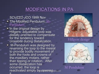MODIFICATIONS IN PAMODIFICATIONS IN PA
SCUZZO JCO 1999 NovSCUZZO JCO 1999 Nov
The Modified PendulumThe Modified Pendulum:: M-M-
PendulumPendulum
In the original design byIn the original design by
Hillgers, adjustable loop wasHillgers, adjustable loop was
distally oriented to compensatedistally oriented to compensate
for the tendency towardfor the tendency toward
crossbite during distalization.crossbite during distalization.
M-Pendulum was designed byM-Pendulum was designed by
reversing the loop to the mesialreversing the loop to the mesial
to provide bodily movement ofto provide bodily movement of
both the roots and crowns ofboth the roots and crowns of
the maxillary molars, ratherthe maxillary molars, rather
than tipping or rotation. Afterthan tipping or rotation. After
some distalization hassome distalization has
occurred, the loop isoccurred, the loop is
reactivated simply by openingreactivated simply by opening
Hillgers design
M Pendulum
www.indiandentalacademy.comwww.indiandentalacademy.com
 