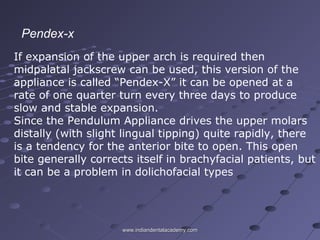If expansion of the upper arch is required then
midpalatal jackscrew can be used, this version of the
appliance is called “Pendex-X” it can be opened at a
rate of one quarter turn every three days to produce
slow and stable expansion.
Since the Pendulum Appliance drives the upper molars
distally (with slight lingual tipping) quite rapidly, there
is a tendency for the anterior bite to open. This open
bite generally corrects itself in brachyfacial patients, but
it can be a problem in dolichofacial types
Pendex-x
www.indiandentalacademy.comwww.indiandentalacademy.com
 