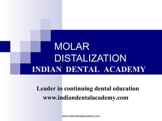 MOLAR
DISTALIZATION
INDIAN DENTAL ACADEMY
Leader in continuing dental education
www.indiandentalacademy.com
www.indiandentalacademy.com

 