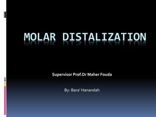 MOLAR DISTALIZATION
Supervisor Prof.Dr Maher Fouda
By: Bara’ Hanandah
 