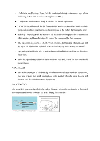 MOLAR DISTALIZATION , headgear, fixed functional | PDF