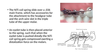 Comprehensive Overview of Molar Distalization in Orthodontics ...