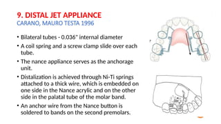 Distalisation Jet Comprehensive Overview of Molar Distalization in Orthodontics ...