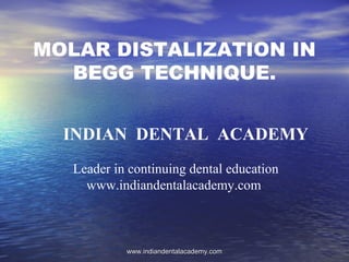 MOLAR DISTALIZATION IN
BEGG TECHNIQUE.
INDIAN DENTAL ACADEMY
Leader in continuing dental education
www.indiandentalacademy.com

www.indiandentalacademy.com

 