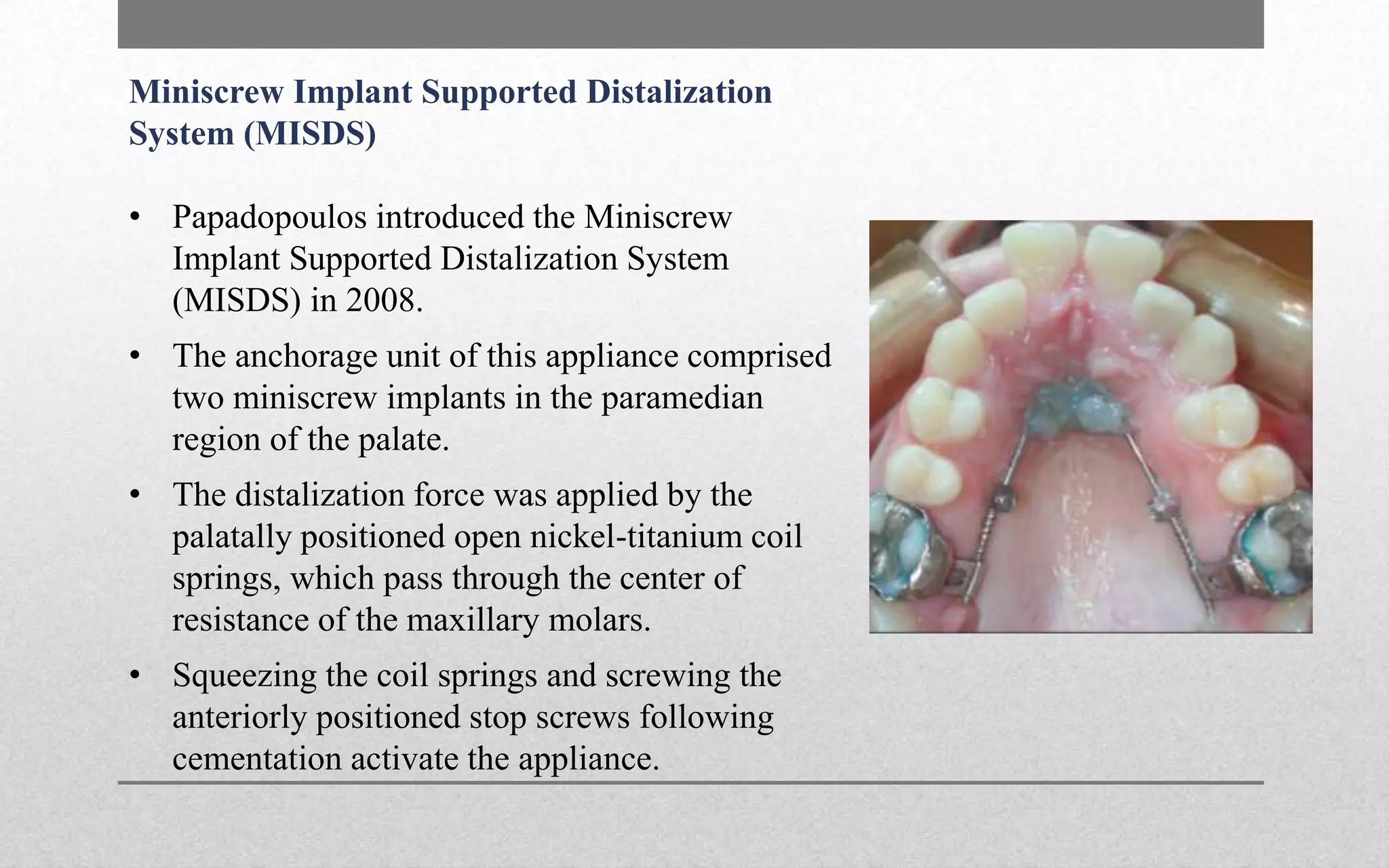 Molar distalisation in Orthodontics | PPTX