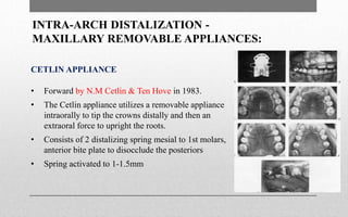Molar distalisation in Orthodontics | PPTX