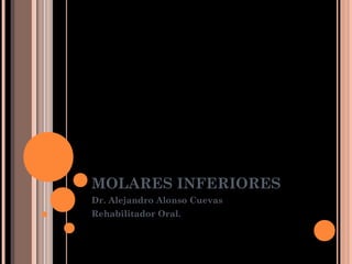 MOLARES INFERIORES
Dr. Alejandro Alonso Cuevas
Rehabilitador Oral.
 