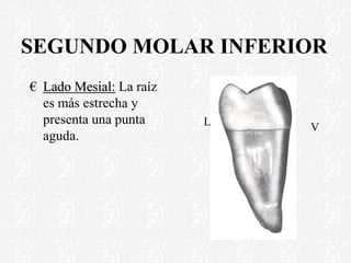 SEGUNDO MOLAR INFERIOR
€ Lado Mesial: La raíz
es más estrecha y
presenta una punta
aguda.
L V
 