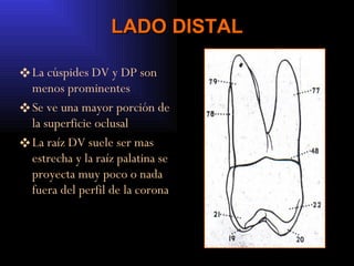 LADO DISTAL La cúspides DV y DP son menos prominentes  Se ve una mayor porción de la superficie oclusal La raíz DV suele ser mas estrecha y la raíz palatina se proyecta muy poco o nada fuera del perfil de la corona 