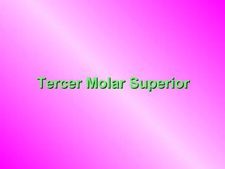 Tercer Molar Superior 