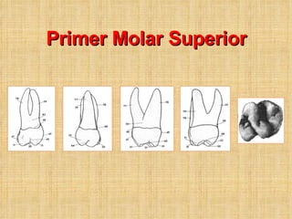 Primer Molar Superior 