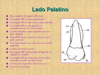 Lado Palatino Dos cúspides de tamaño diferente  La cúspide MP es muy prominente  La cúspide DP es mas corta y mas estrecha  La cúspide DP es más grande en comparación de los otros molares  Las dos cúspides están separadas por un surco lingual El perfil M de la corona es convexa en la parte cervical  Por D presentan una curva da convexidad uniforme  La línea cervical es recta  La cúspide MP corresponde al lugar de la cúspide de carabeli La cúspide DP presenta una convexidad marcada en todas las direcciones Las tres raíces pueden observarse  por  L  La raíz P es mas larga 