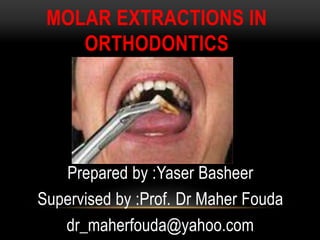 MOLAR EXTRACTIONS IN
ORTHODONTICS
Prepared by :Yaser Basheer
Supervised by :Prof. Dr Maher Fouda
dr_maherfouda@yahoo.com
 