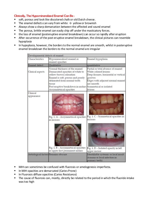 Molar incisor hypomineralization