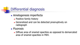 Molar incisor hypomineralization (MIH) ojus | PPTX