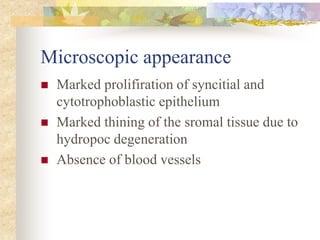 Microscopic appearance
 Marked prolifiration of syncitial and
cytotrophoblastic epithelium
 Marked thining of the sromal tissue due to
hydropoc degeneration
 Absence of blood vessels
 
